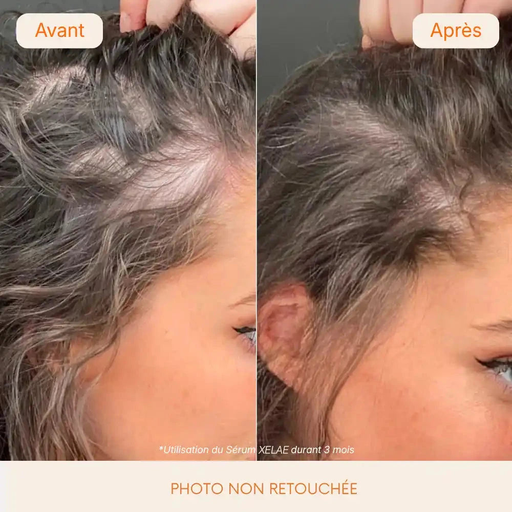 Antes y después en pelo canoso