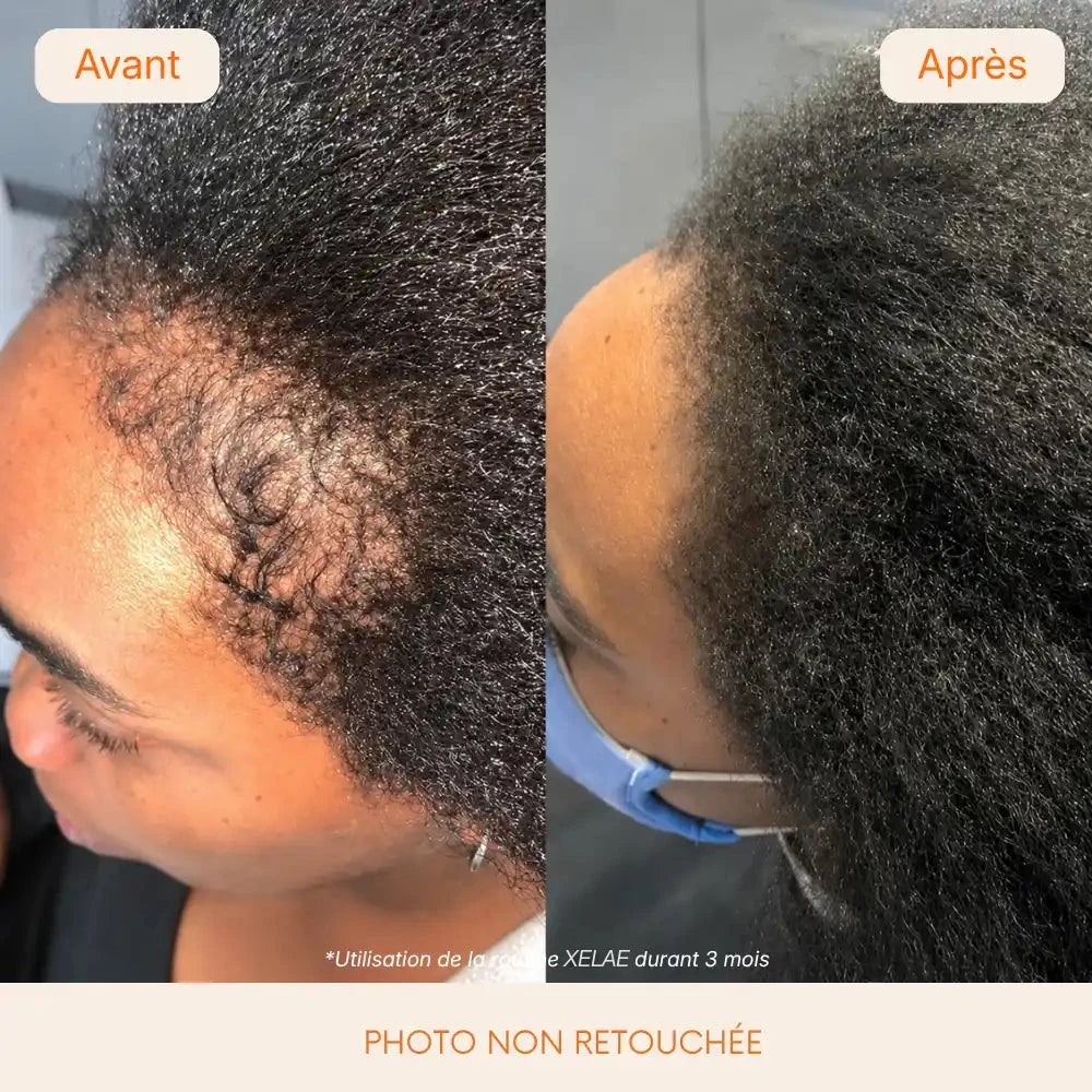 Avant et après sur cheveux crépus