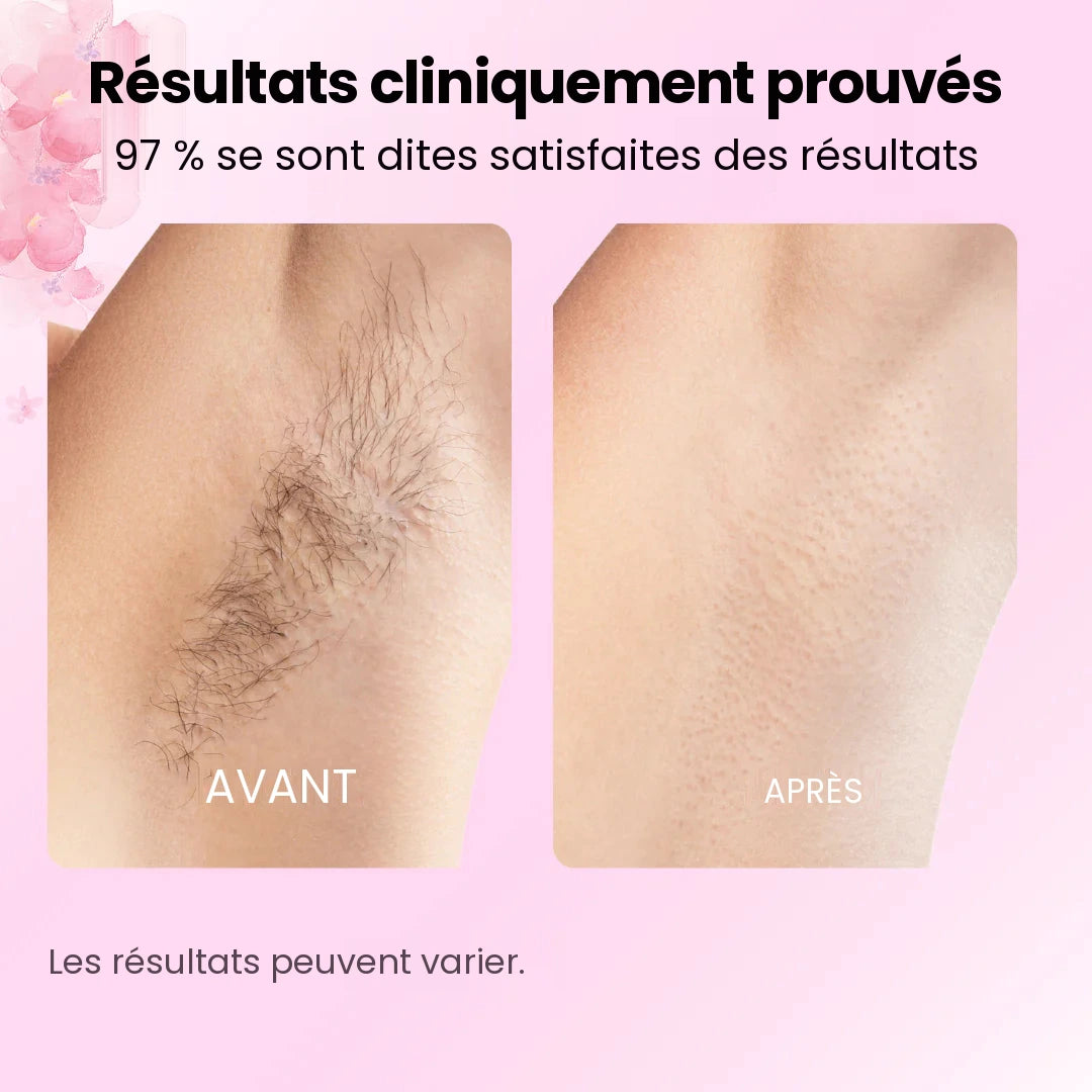 Résultats cliniquement prouvés : avant et après sur les aisselles