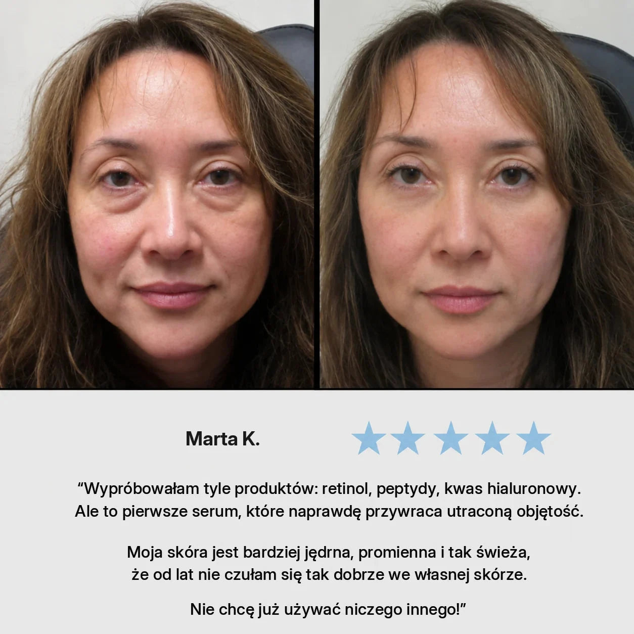 Opinia klientki o serum VoluFine XELAE
