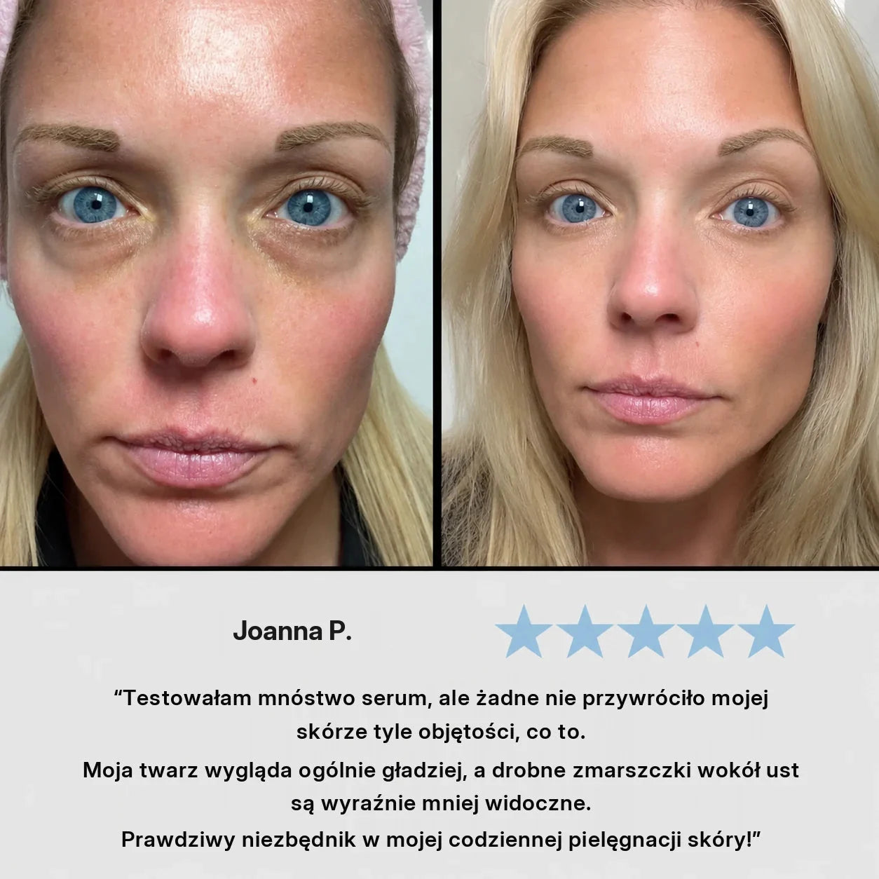 Opinia klientki o serum VoluFine XELAE